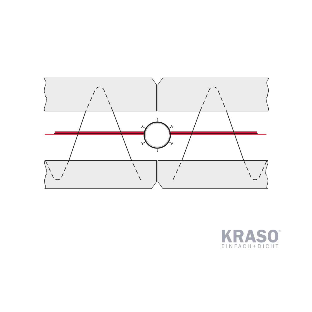 KRASOflex Sternrohr System
